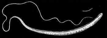 Trichuris egenskaper, morfologi, livsmiljö, arter