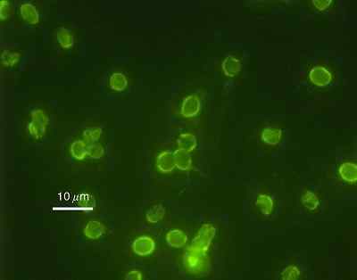 Caractéristiques de Cryptosporidium, espèces, contagion, symptômes