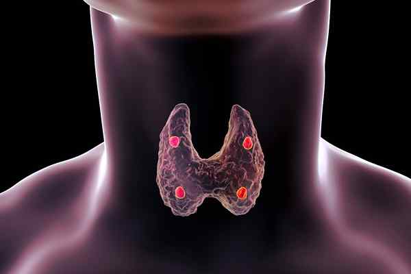 Types, fonctions, inflammation et glandes de la maladie