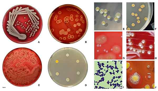 Bacteriële koloniale morfologie