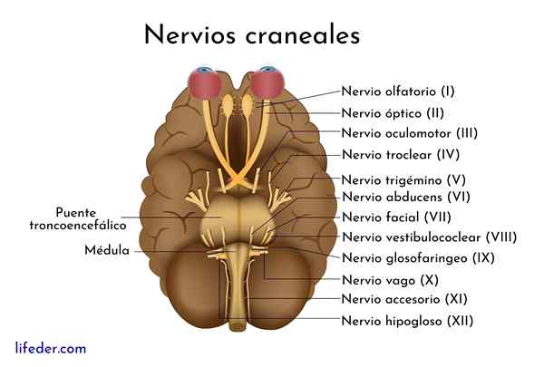 Craniale paren