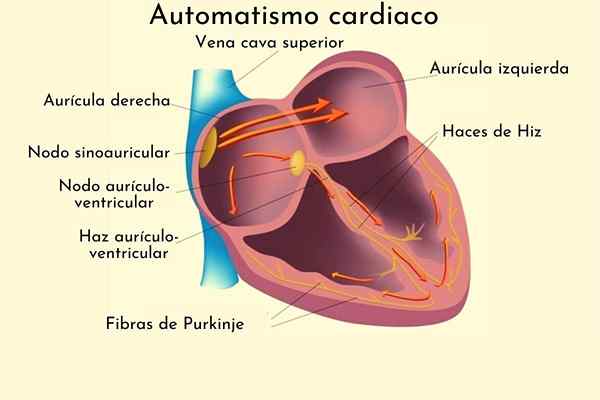 Hartautomatisme