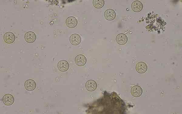 Entamoeba coli