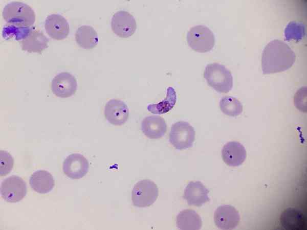 Plasmodium falciparum