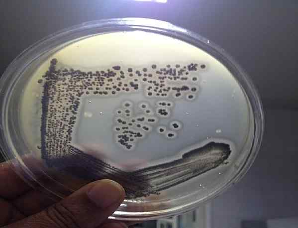 Baird Parker Agar What Is, Foundation, przygotowanie, użycie