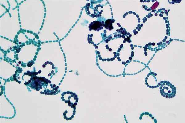 Anabaena -Eigenschaften, Lebensraum, Fortpflanzung, Ernährung