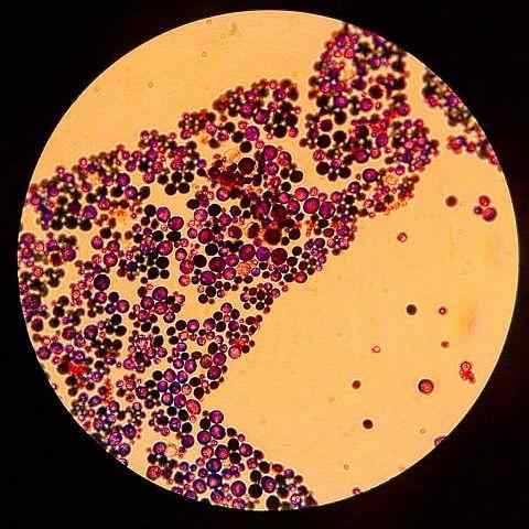 Kulat dimorphic apa dan contoh