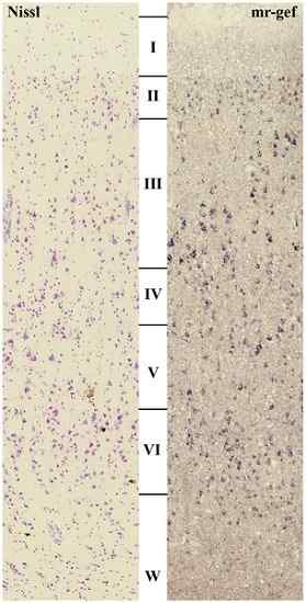 Neocortex -functie, structuur en pathologie