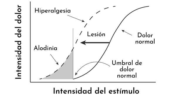 Teoria do portão