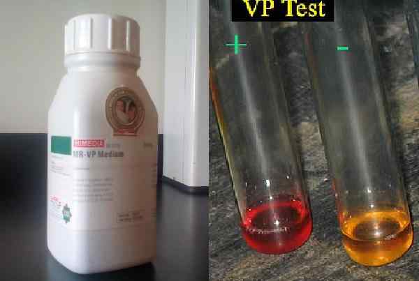 Voges-Proskauer Test What Is, Foundation, przygotowanie, używa