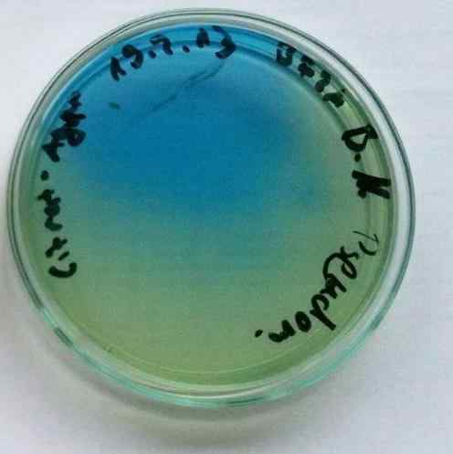 Simmons Citrat Agar