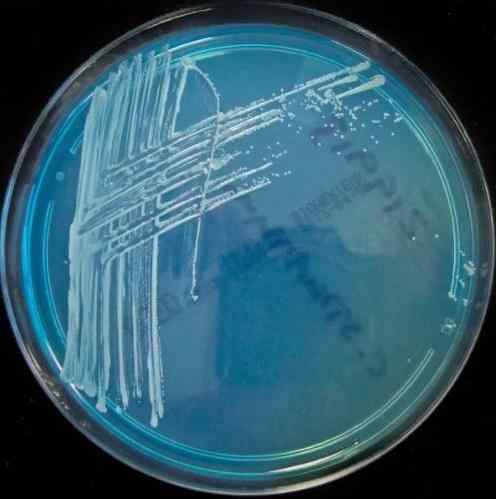 Gestreepte agar