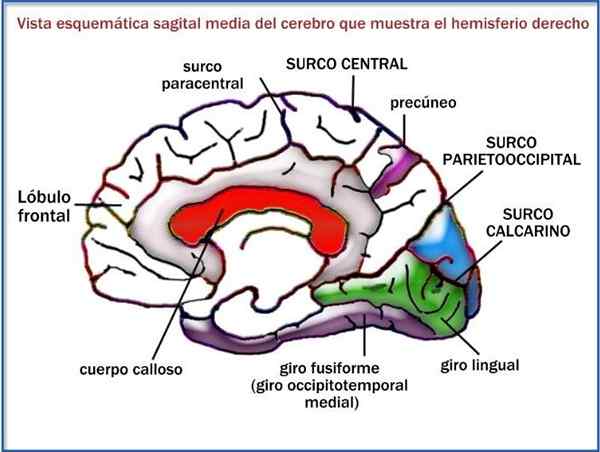 Fissuras cerebrais