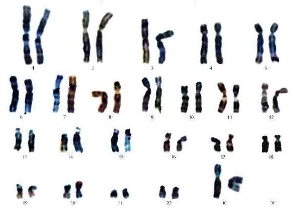 Dotazione cromosomica