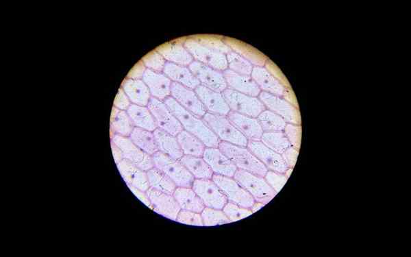 Epiderma cibule